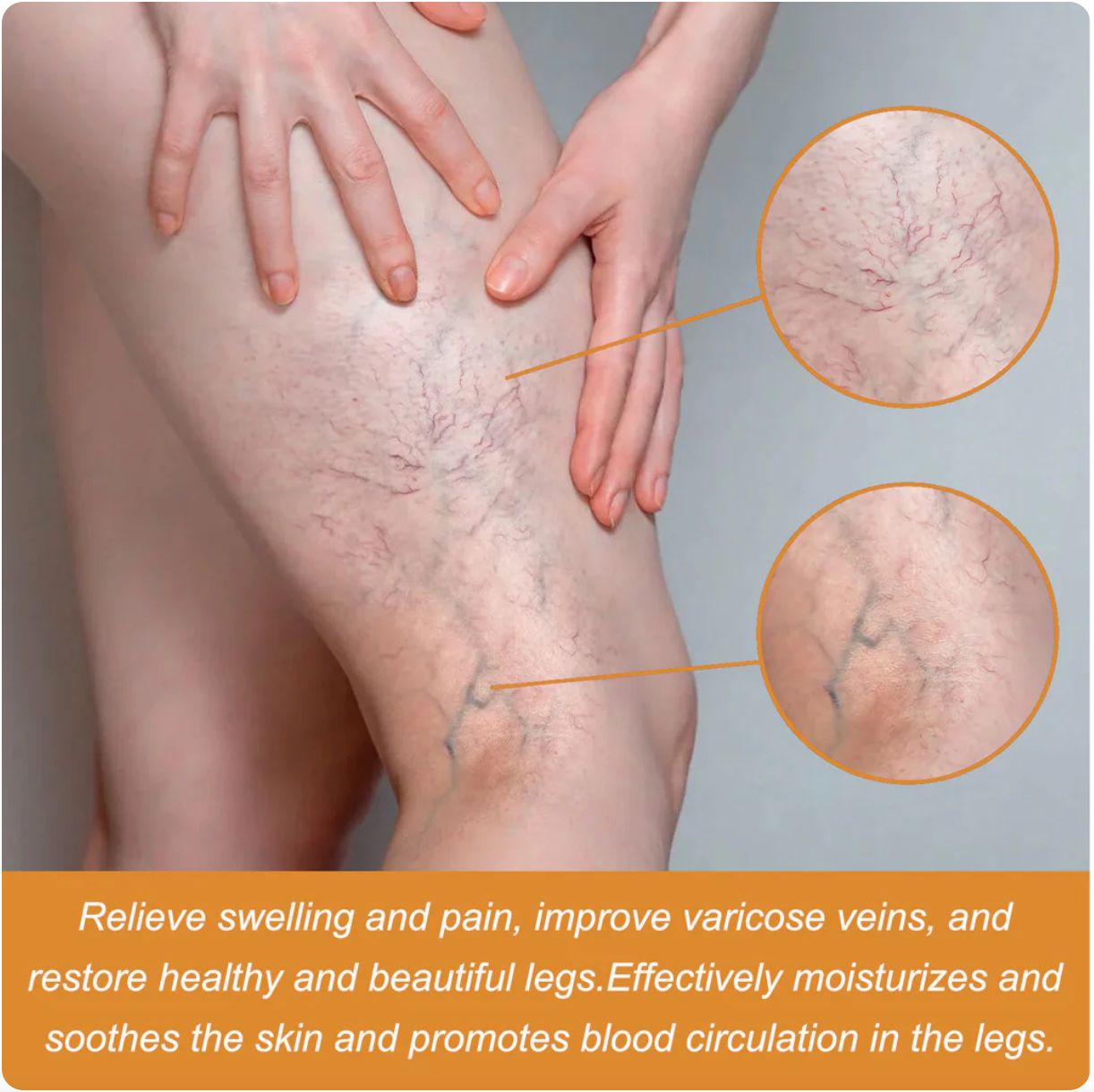 Venom Varicose Vein Relief Spray (BUY 1 GET 2 FREE 🎁)