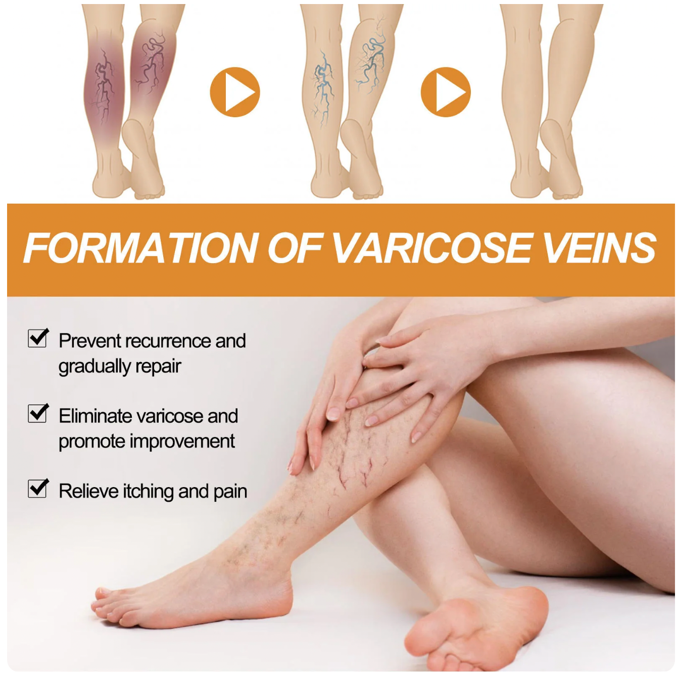 FlexoDerm Varicose Vein Relief Spray (BUY 1 GET 2 FREE 🎁)