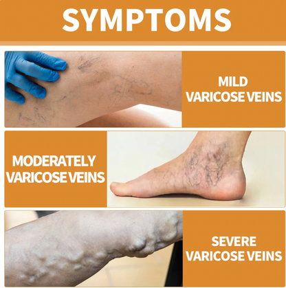 FlexoDerm Varicose Vein Relief Spray (BUY 1 GET 2 FREE 🎁)