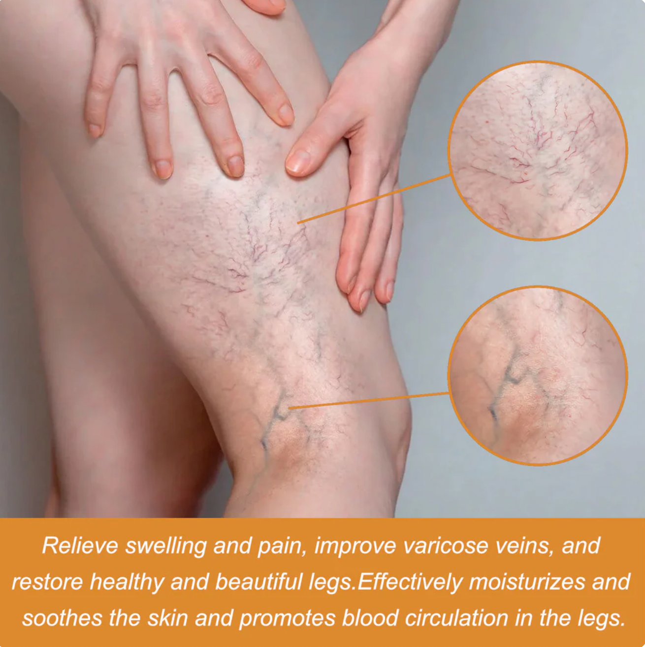 FlexoDerm Varicose Vein Relief Spray (BUY 1 GET 2 FREE 🎁)