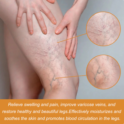 FlexoDerm Varicose Vein Relief Spray (BUY 1 GET 2 FREE 🎁)