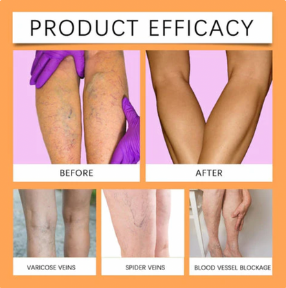 FlexoDerm Varicose Vein Relief Spray (BUY 1 GET 2 FREE 🎁)